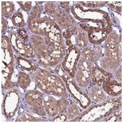 NARFL, Rabbit, Polyclonal Antibody, Abnova 100&mu;L; Unlabeled:Antibodies,