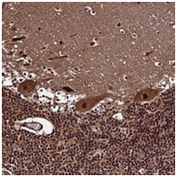 MED19 Rabbit anti-Human, Polyclonal Antibody, Abnova 100 &mu;L | Buy Online | Abnova Corporation | Fisher Scientific