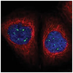 MED19 Rabbit anti-Human, Polyclonal Antibody, Abnova 100 &mu;L | Buy Online | Abnova Corporation | Fisher Scientific