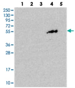 PGBD4, Rabbit, Polyclonal Antibody, Abnova 100 &mu;L | Buy Online | Abnova Corporation | Fisher Scientific