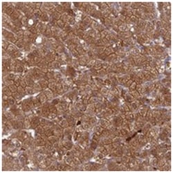 PGBD4, Rabbit, Polyclonal Antibody, Abnova 100 &mu;L | Buy Online | Abnova Corporation | Fisher Scientific