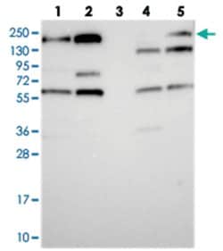 MYO5B Rabbit anti-Human, Polyclonal Antibody, Abnova 100 &mu;L | Buy Online | Abnova Corporation | Fisher Scientific