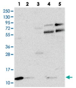 C18orf32, Rabbit, Polyclonal Antibody, Abnova 100 &mu;L | Buy Online | Abnova Corporation | Fisher Scientific