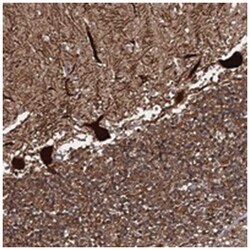 C18orf32, Rabbit, Polyclonal Antibody, Abnova 100 &mu;L | Buy Online | Abnova Corporation | Fisher Scientific