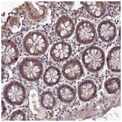 FAM98C Rabbit anti-Human, Polyclonal Antibody, Abnova 100 &mu;L | Buy Online | Abnova Corporation | Fisher Scientific