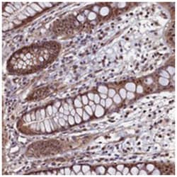 LEO1 Rabbit anti-Human, Polyclonal Antibody, Abnova 100 &mu;L | Buy Online | Abnova Corporation | Fisher Scientific