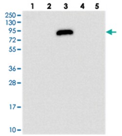 IGFALS Rabbit anti-Human, Polyclonal Antibody, Abnova 100 &mu;L | Buy Online | Abnova Corporation | Fisher Scientific