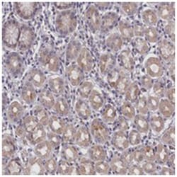 IGFALS Rabbit anti-Human, Polyclonal Antibody, Abnova 100 &mu;L | Buy Online | Abnova Corporation | Fisher Scientific
