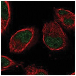 IGFALS Rabbit anti-Human, Polyclonal Antibody, Abnova 100 &mu;L | Buy Online | Abnova Corporation | Fisher Scientific