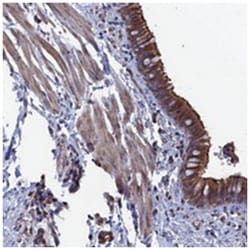 NUTF2 Rabbit anti-Human, Polyclonal Antibody, Abnova 100 &mu;L | Buy Online | Abnova Corporation | Fisher Scientific