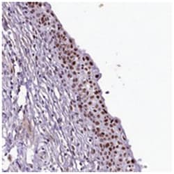 SAMD10, Rabbit, Polyclonal Antibody, Abnova 100 &mu;L | Buy Online | Abnova Corporation | Fisher Scientific