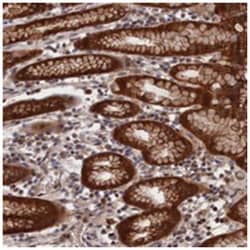 RMI2, Rabbit, Polyclonal Antibody, Abnova 100&mu;L; Unlabeled:Antibodies,