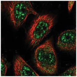 RMI2, Rabbit, Polyclonal Antibody, Abnova 100&mu;L; Unlabeled:Antibodies,