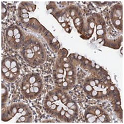 FSIP1, Rabbit, Polyclonal Antibody, Abnova 100&mu;L; Unlabeled:Antibodies,