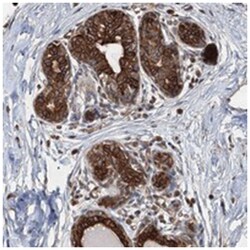 AGRP, Rabbit, Polyclonal Antibody, Abnova 100 &mu;L | Buy Online | Abnova | Fisher Scientific