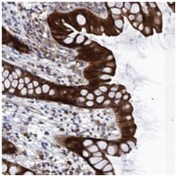 FAM92B, Rabbit, Polyclonal Antibody, Abnova 100 &mu;L | Buy Online | Abnova | Fisher Scientific