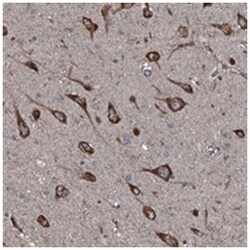 SLC25A38, Rabbit, Polyclonal Antibody, Abnova 100 &mu;L | Buy Online | Abnova Corporation | Fisher Scientific