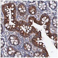 OTOL1, Rabbit, Polyclonal Antibody, Abnova 100 &mu;L | Buy Online | Abnova Corporation | Fisher Scientific