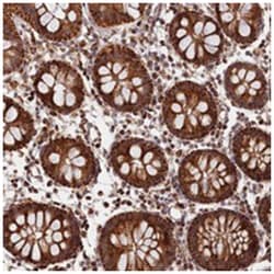 MACROD1, Rabbit, Polyclonal Antibody, Abnova 100 &mu;L | Buy Online | Abnova Corporation | Fisher Scientific