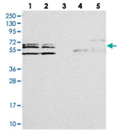 C2orf44, Rabbit, Polyclonal Antibody, Abnova 100&mu;L; Unlabeled:Antibodies,