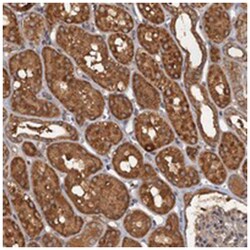 C2orf44, Rabbit, Polyclonal Antibody, Abnova 100&mu;L; Unlabeled:Antibodies,