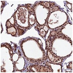 N4BP1 Rabbit anti-Human, Polyclonal Antibody, Abnova 100&mu;L; Unlabeled:Antibodies,