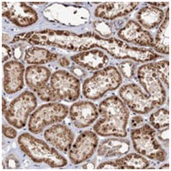 C16orf45, Rabbit, Polyclonal Antibody, Abnova 100 &mu;L | Buy Online | Abnova Corporation | Fisher Scientific