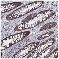 PPP1R3D, Rabbit, Polyclonal Antibody, Abnova 100 &mu;L | Buy Online | Abnova Corporation | Fisher Scientific