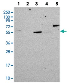 CORO2A Rabbit anti-Human, Polyclonal Antibody, Abnova 100 &mu;L | Buy Online | Abnova Corporation | Fisher Scientific