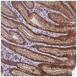CORO2A Rabbit anti-Human, Polyclonal Antibody, Abnova 100 &mu;L | Buy Online | Abnova Corporation | Fisher Scientific