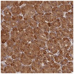 KATNB1 Rabbit anti-Human, Polyclonal Antibody, Abnova 100&mu;L; Unlabeled:Antibodies,