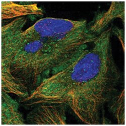 KATNB1 Rabbit anti-Human, Polyclonal Antibody, Abnova 100&mu;L; Unlabeled:Antibodies,