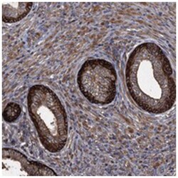TXNDC11 Rabbit anti-Human, Polyclonal Antibody, Abnova 100 &mu;L | Buy Online | Abnova Corporation | Fisher Scientific