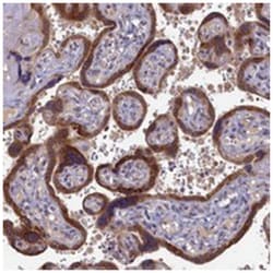 DNAJC17 Rabbit anti-Human, Polyclonal Antibody, Abnova 100&mu;L; Unlabeled:Antibodies,