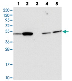 ATF7IP2 Rabbit anti-Human, Polyclonal Antibody, Abnova 100 &mu;L | Buy Online | Abnova Corporation | Fisher Scientific