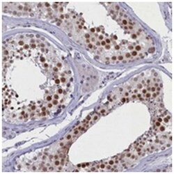 ATF7IP2 Rabbit anti-Human, Polyclonal Antibody, Abnova 100 &mu;L | Buy Online | Abnova Corporation | Fisher Scientific