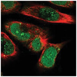 ATF7IP2 Rabbit anti-Human, Polyclonal Antibody, Abnova 100 &mu;L | Buy Online | Abnova Corporation | Fisher Scientific