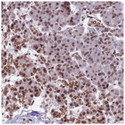 PTCHD4, Rabbit, Polyclonal Antibody, Abnova 100 &mu;L | Buy Online | Abnova Corporation | Fisher Scientific