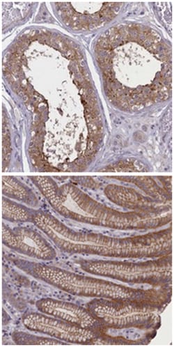 CORO2A Rabbit anti-Human, Polyclonal Antibody, Abnova 100 &mu;L | Buy Online | Abnova Corporation | Fisher Scientific