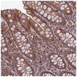 SLC9A5 Rabbit anti-Human, Polyclonal Antibody, Abnova 100&mu;L; Unlabeled:Antibodies,