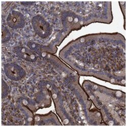 C10orf47, Rabbit, Polyclonal Antibody, Abnova 100 &mu;L | Buy Online | Abnova Corporation | Fisher Scientific