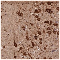 KARS Rabbit anti-Human, Polyclonal Antibody, Abnova 100 &mu;L | Buy Online | Abnova Corporation | Fisher Scientific