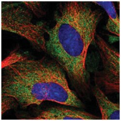 KARS Rabbit anti-Human, Polyclonal Antibody, Abnova 100 &mu;L | Buy Online | Abnova Corporation | Fisher Scientific