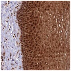 DHX38, Rabbit, Polyclonal Antibody, Abnova 100&mu;L; Unlabeled:Antibodies,
