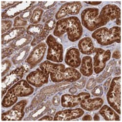 TELO2 Rabbit anti-Human, Polyclonal Antibody, Abnova 100&mu;L; Unlabeled:Antibodies,