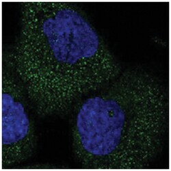 TELO2 Rabbit anti-Human, Polyclonal Antibody, Abnova 100&mu;L; Unlabeled:Antibodies,