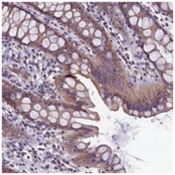 CACNG8, Rabbit, Polyclonal Antibody, Abnova 100&mu;L; Unlabeled:Antibodies,