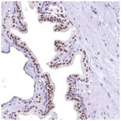 FLYWCH2, Rabbit, Polyclonal Antibody, Abnova 100 &mu;L | Buy Online | Abnova Corporation | Fisher Scientific