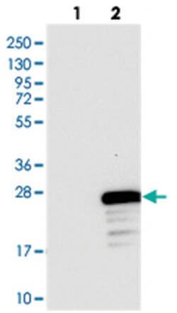 FLYWCH2, Rabbit, Polyclonal Antibody, Abnova 100 &mu;L | Buy Online | Abnova Corporation | Fisher Scientific