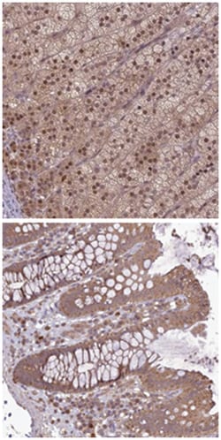 TIGD7 Rabbit anti-Human, Polyclonal Antibody, Abnova 100 &mu;L | Buy Online | Abnova Corporation | Fisher Scientific